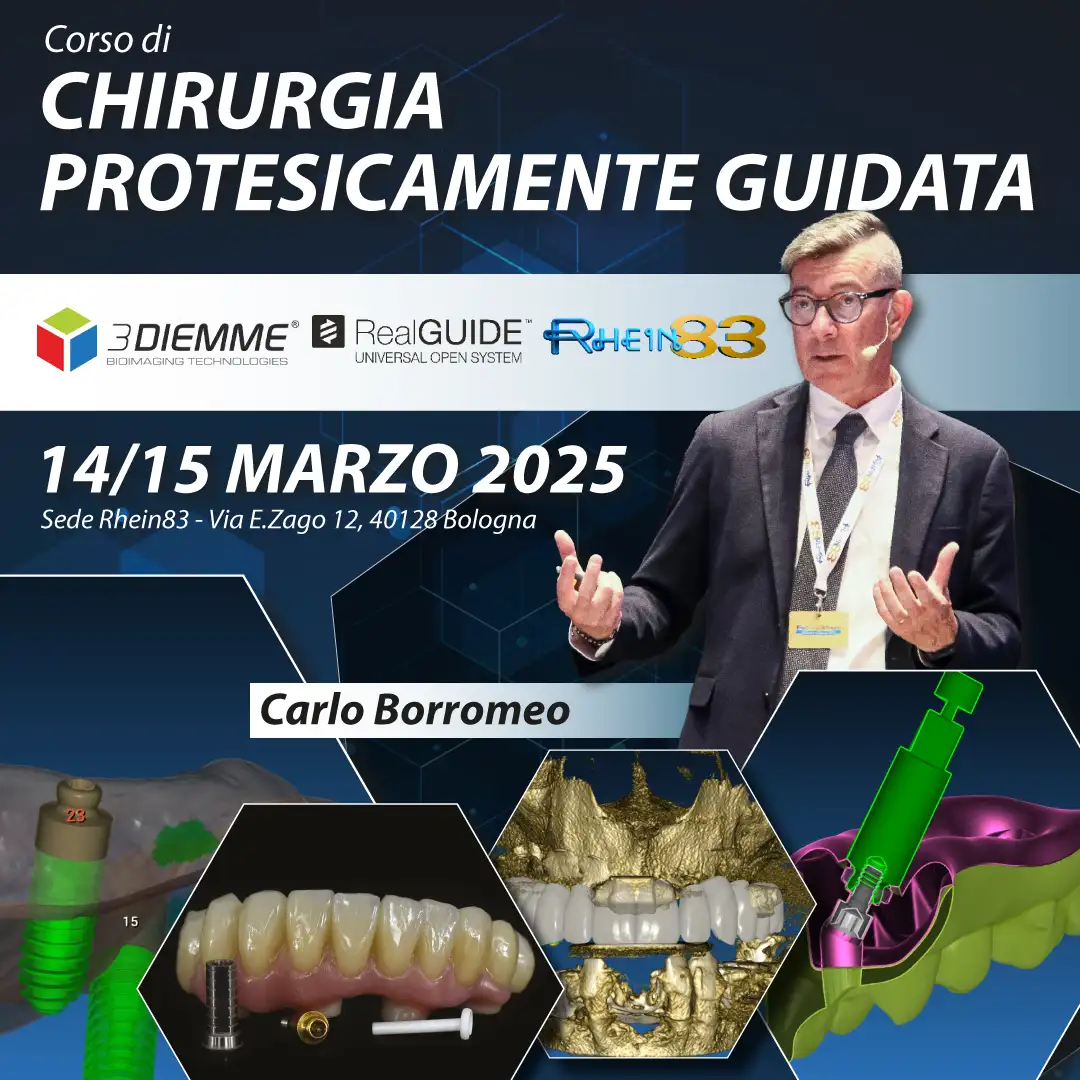 Chirurgia protesicamente guidata